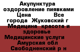 Акупунктура, оздоровление пиявками › Цена ­ 3 000 - Все города, Жуковский г. Медицина, красота и здоровье » Медицинские услуги   . Амурская обл.,Свободненский р-н